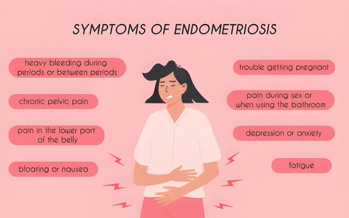 Uncommon Symptoms of Silent Endometriosis