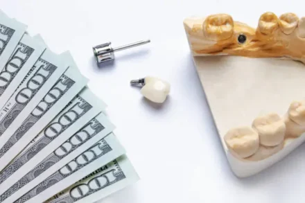 Understanding All on 4 Dental Implants Cost: A Comprehensive Guide