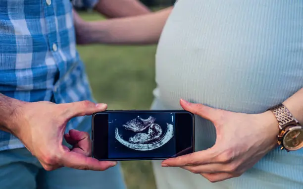 Understanding the Importance of a Dating Scan in Early Pregnancy