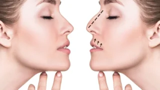 Understanding the Rhinoplasty Procedure: What to Expect and How It Can Transform Your Appearance
