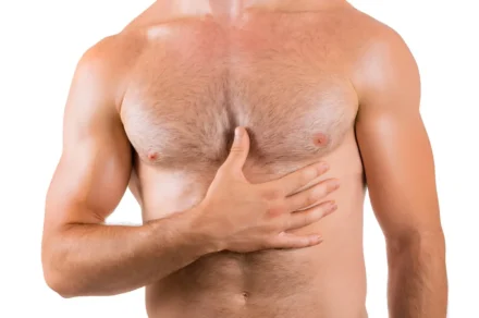 Male Chest Changes: Causes, Concerns, And Treatment Options